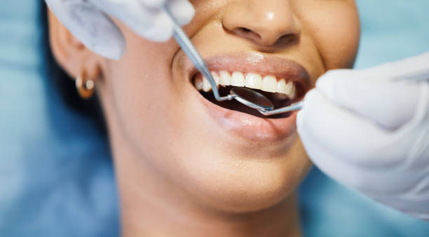 Best Walk-In Emergency Dentist in Homer Glen, IL